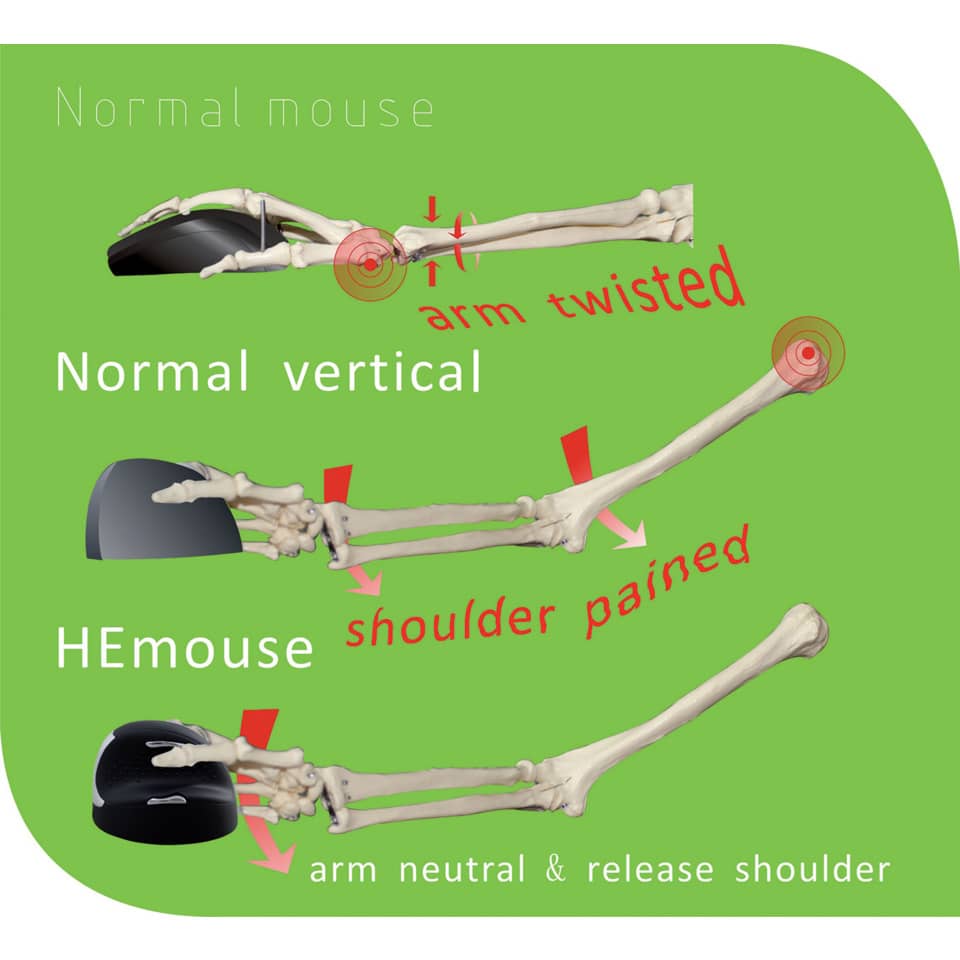 Skelett, Arm, Ellenbogen, Gelenk, medizinisches Gerät