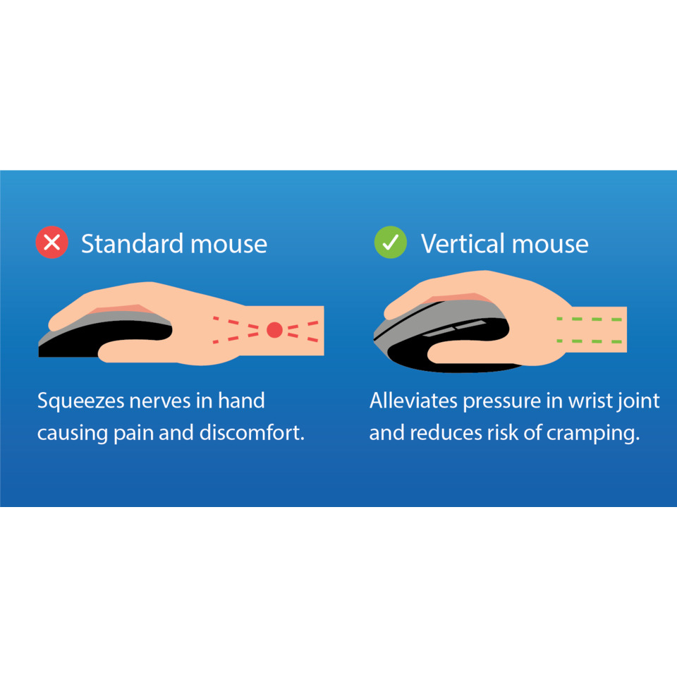 ergonomischer mausgriff, vertikale maus, handgrafik, nervengefäße, cramping vermeidung